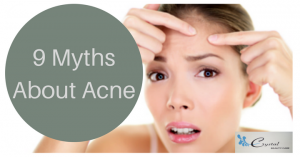 9 Myths About Acne